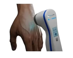 Üniversite öğrencisi babasının hastalığından yola çıkarak vitiligo tedavisi için cihaz geliştirdi