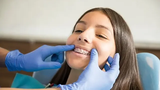 Ortodontik Tedaviler İçin ‘Ergenlik’ En İdeal Dönem